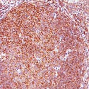 Formalin-fixed, paraffin-embedded human Tonsil stained with BCL-10 Monoclonal Antibody (151).