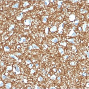 Formalin-fixed, paraffin-embedded human Brain stained with p14ARF Mouse Monoclonal Antibody (4C6/4).