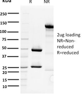 SDS-PAGE Analysis Purified ORC1 Mouse Monoclonal Antibody (7F6/1). Confirmation of Purity and Integrity of Antibody.