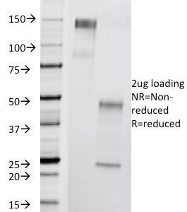SDS-PAGE Analysis Purified T-F Antigen Mouse Monoclonal Antibody (A84-A/F10). Confirmation of Purity and Integrity of Antibody.