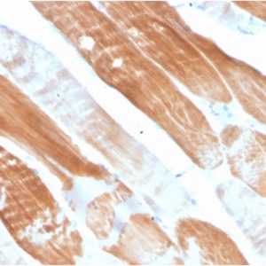 Formalin-fixed, paraffin-embedded human Skeletal Muscle stained with Sarcomeric Actinin Alpha 2 Mouse Monoclonal Antibody (ACTN2/3291).