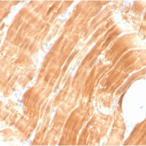 Formalin-fixed, paraffin-embedded human Skeletal Muscle stained with Sarcomeric Actinin Alpha 2 Mouse Monoclonal Antibody (ACTN2/3294).
