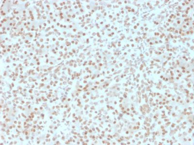 Formalin-fixed, paraffin-embedded human Pancreas stained with AKT1 Mouse Monoclonal Antibody (AKT1/2491).