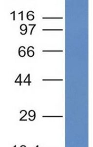 Western Blot Analysis of recombinant fragment of ALK using ALK Monoclonal Antibody (ALK/1031).