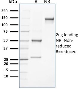 SDS-PAGE Analysis Purified CLEC9A Mouse Monoclonal Antibody (8F9). Confirmation of Integrity and Purity of Antibody.