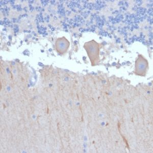 Formalin-fixed, paraffin-embedded human Brain stained with ATG5 Mouse Monoclonal Antibody (ATG5/2492).
