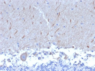 Formalin-fixed, paraffin-embedded human Brain stained with ATG5 Mouse Monoclonal Antibody (ATG5/2553).