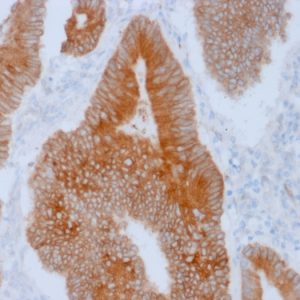 Formalin-fixed, paraffin-embedded human Colon stained with Aurora B Mouse Monoclonal Antibody (AURKB/1592).