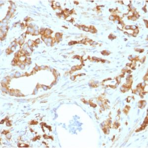 Formalin-fixed, paraffin-embedded human Prostate stained with Aurora B Mouse Monoclonal Antibody (AURKB/1593).