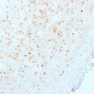 Formalin-fixed, paraffin-embedded human Tonsil stained with Aurora B Mouse Monoclonal Antibody (AURKB/1845).