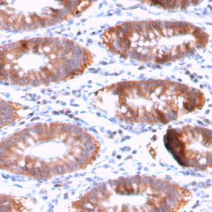 Formalin-fixed, paraffin-embedded human Colon stained with Aurora B Rabbit Recombinant Monoclonal Antibody (AURKB/3121R).
