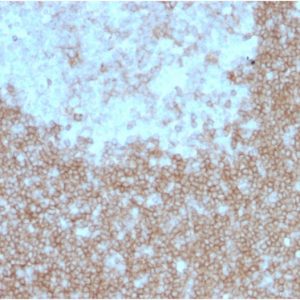 Formalin-fixed, paraffin-embedded human Tonsil stained with CD268 / BAFFR Mouse Monoclonal Antibody (BAFFR/1557).