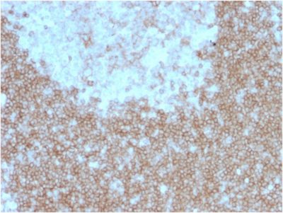 Formalin-fixed, paraffin-embedded human Tonsil stained with CD268 / BAFFR Mouse Monoclonal Antibody (BAFFR/1557).