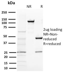 SDS-PAGE Analysis Purified BAP1 Mouse Monoclonal Antibody (BAP1/2431). Confirmation of Purity and Integrity of Antibody.