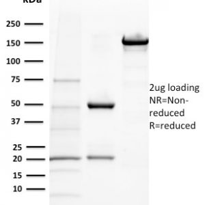 SDS-PAGE Analysis Purified BAP1 Mouse Monoclonal Antibody (BAP1/2432). Confirmation of Purity and Integrity of Antibody.