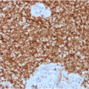 Formalin-fixed, paraffin-embedded human Spleen stained with Bcl-2 Rabbit Recombinant Monoclonal Antibody (BCL2/1878R).