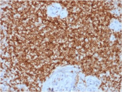 Formalin-fixed, paraffin-embedded human Spleen stained with Bcl-2 Rabbit Recombinant Monoclonal Antibody (BCL2/1878R).