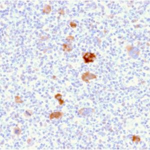 SDS-PAGE Analysis Purified Bcl-x Mouse Monoclonal Antibody (BCL2L1/2406). Confirmation of Purity and Integrity of Antibody.