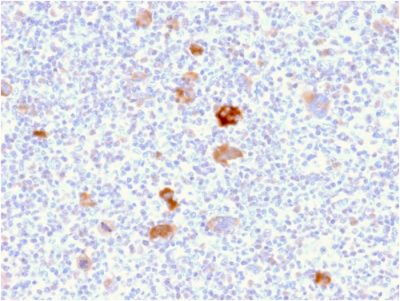 SDS-PAGE Analysis Purified Bcl-x Mouse Monoclonal Antibody (BCL2L1/2406). Confirmation of Purity and Integrity of Antibody.