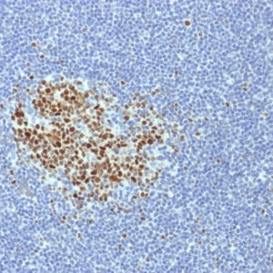 Formalin-fixed, paraffin-embedded human Tonsil stained with BCL-6 Mouse Monoclonal Antibody (BCL6/1718).