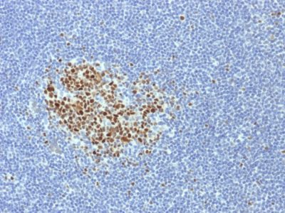 Formalin-fixed, paraffin-embedded human Tonsil stained with BCL-6 Mouse Monoclonal Antibody (BCL6/1718).