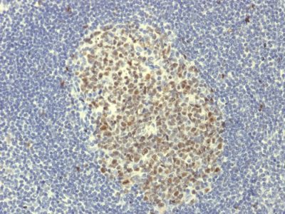Formalin-fixed, paraffin-embedded human Tonsil stained with bcl-6 Rabbit Recombinant Monoclonal Antibody (BCL6/1951R).