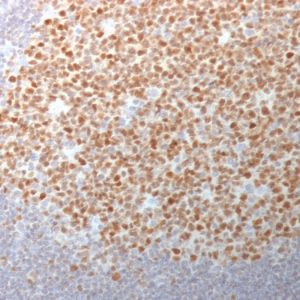 Formalin-fixed, paraffin-embedded human Tonsil stained with BCL-6 Mouse Monoclonal Antibody (BCL6/1982).