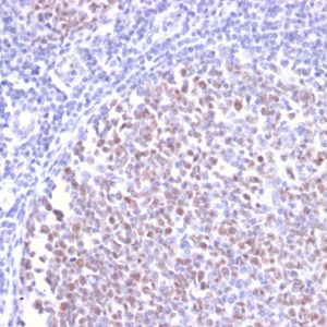 Formalin-fixed, paraffin-embedded human Tonsil stained with BCL-6 Rabbit Recombinant Monoclonal Antibody (BCL6/2497R).