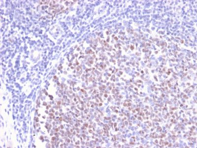 Formalin-fixed, paraffin-embedded human Tonsil stained with BCL-6 Rabbit Recombinant Monoclonal Antibody (BCL6/2497R).