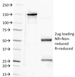 SDS-PAGE Analysis Purified CD100 Mouse Monoclonal Antibody (A8). Confirmation of Purity and Integrity of Antibody.