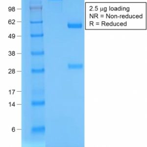 SDS-PAGE Analysis Purified BrdU Rabbit Recombinant Monoclonal Antibody (BRD/1539R). Confirmation of Purity and Integrity of Antibody.