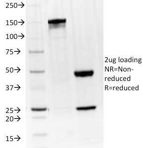 SDS-PAGE Analysis Purified BTLA Mouse Monoclonal Antibody (BTLA/1528). Confirmation of Integrity and Purity of Antibody.