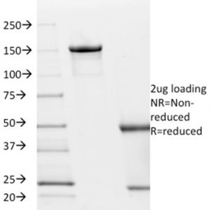 SDS-PAGE Analysis Purified p21 Mouse Monoclonal Antibody (AC8). Confirmation of Integrity and Purity of Antibody.