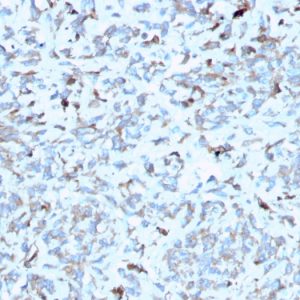 Formalin-fixed, paraffin-embedded human Kidney stained with C1QA Mouse Monoclonal Antibody (C1QA/2952).