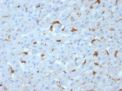 Formalin-fixed, paraffin-embedded human Liver stained with C1QA Mouse Monoclonal Antibody (C1QA/2953).