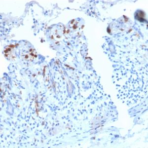 Formalin-fixed, paraffin-embedded human Small Intestine stained with CD209 Recombinant Rabbit Monoclonal Antibody (C209/2749R).