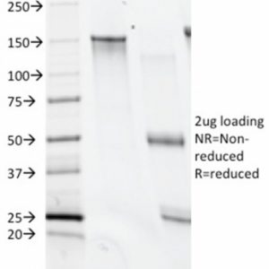 SDS-PAGE Analysis Purified CD28 Mouse Monoclonal Antibody (C28/74). Confirmation of Integrity and Purity of Antibody.