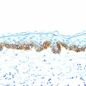 Formalin-fixed, paraffin-embedded human Skin stained with Cytokeratin, LMW Mouse Monoclonal Antibody (AE-1).