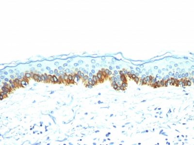 Formalin-fixed, paraffin-embedded human Skin stained with Cytokeratin, LMW Mouse Monoclonal Antibody (AE-1).