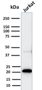 Western Blot of recombinant CD3e and Jurkat cell lysate using CD3e Rabbit Recombinant Monoclonal Antibody (C3e/2858R).