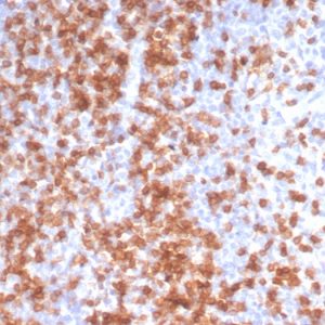 Formalin-fixed, paraffin-embedded human Tonsil stained with CD3e Rabbit Recombinant Monoclonal Antibody (C3e/3125R).