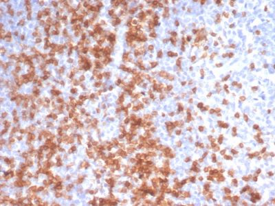 Formalin-fixed, paraffin-embedded human Tonsil stained with CD3e Rabbit Recombinant Monoclonal Antibody (C3e/3125R).