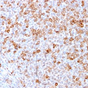 Formalin-fixed, paraffin-embedded human Tonsil stained with CD3e Recombinant Rabbit Monoclonal Antibody (C3e/3171R).