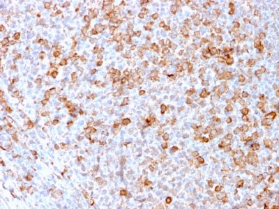 Formalin-fixed, paraffin-embedded human Tonsil stained with CD3e Recombinant Rabbit Monoclonal Antibody (C3e/3171R).