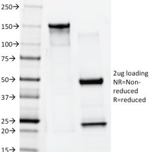 SDS-PAGE Analysis Purified Cytokeratin 10 Mouse Monoclonal Antibody (AE20). Confirmation of Purity and Integrity of Antibody.
