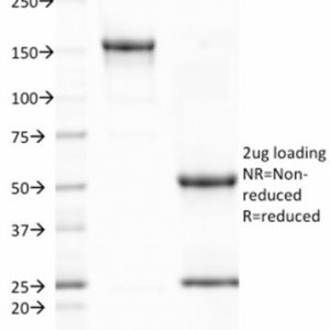 SDS-PAGE Analysis Purified CD80 Mouse Monoclonal Antibody (C80/2723). Confirmation of Integrity and Purity of Antibody.