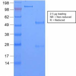 SDS-PAGE Analysis Purified TAG-72 Rabbit Recombinant Monoclonal Antibody (CA72/2869R). Confirmation of Purity and Integrity of Antibody.