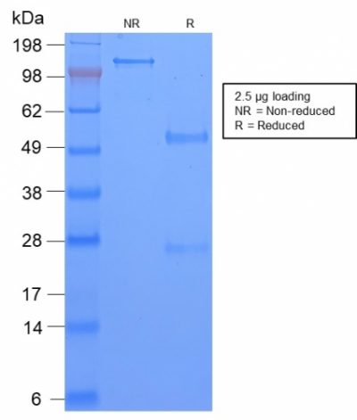 SDS-PAGE Analysis Purified TAG-72 Rabbit Recombinant Monoclonal Antibody (CA72/2869R). Confirmation of Purity and Integrity of Antibody.