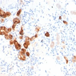Formalin-fixed, paraffin-embedded human Kidney stained with Calbindin 1 Mouse Monoclonal Antibody (CALB1/2782).