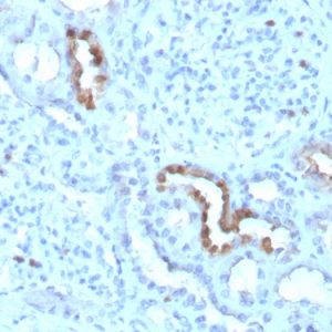 Formalin-fixed, paraffin-embedded human Kidney stained with Calbindin 1 Mouse Monoclonal Antibody (CALB1/3333).